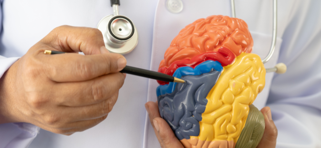 Médico apontando para lobos cerebrais em modelo anatômico durante explicação sobre o progresso do Alzheimer.