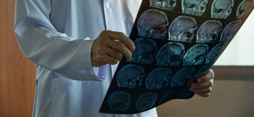 Médico segurando exame de ressonância magnética do crânio, evidenciando a prática clínica da Neurociência aplicada ao diagnóstico.